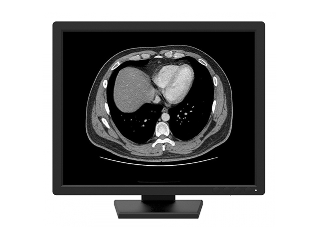 Монохромный медицинский монитор 1 МП Jusha R 190 для мобильного рентгена, ангиографии
