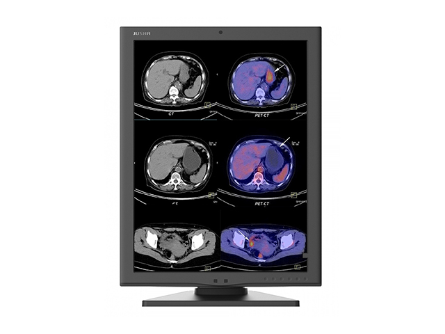 Цветной медицинский монитор 2 МП Jusha C270G для рентгенологии КТ