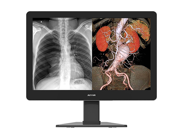 Цветной медицинский монитор 5 МП Jusha C620G многофункциональный с защитным стеклом