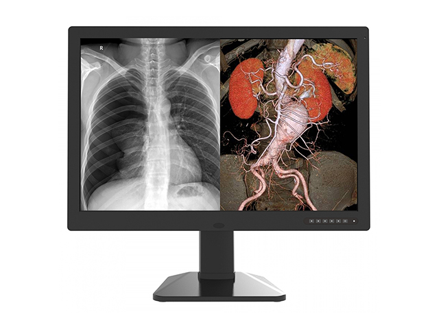 Цветной медицинский монитор 6 МП Jusha C61 многофункциональный