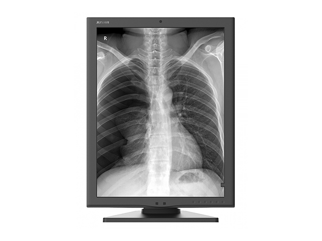Монохромный медицинский монитор 3 МП Jusha M350G для рентгенологии, МРТ