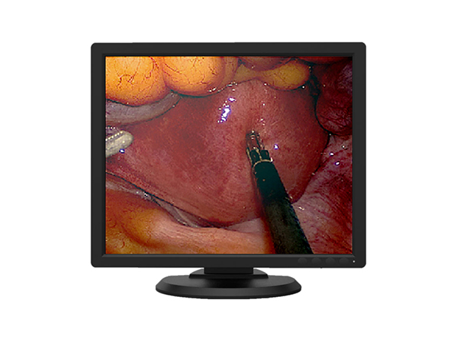 Цветной медицинский монитор 1 МП Jusha E190AG для мобильного рентгена, ангиографии