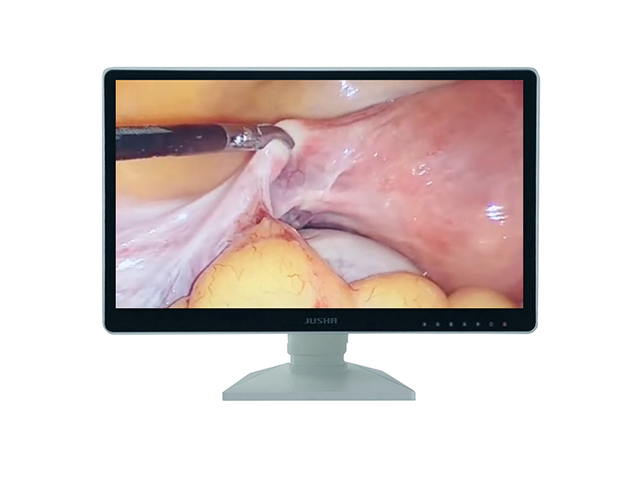 Цветной медицинский монитор 2 МП Jusha E270AG для хирургии, эндоскопии и операции с защитым стеклом