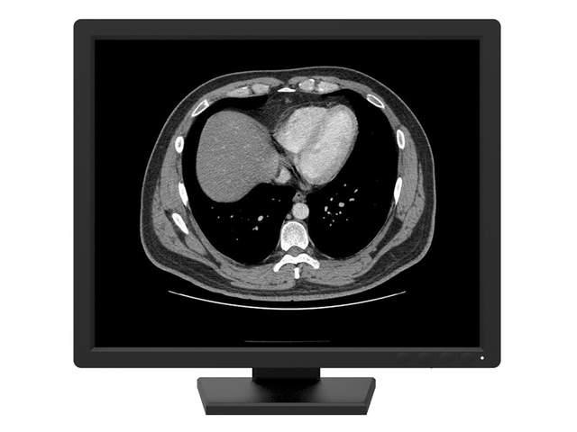 Медицинский монохромный монитор 1 МП Jusha R 190